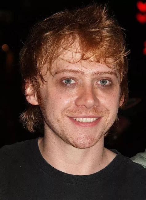 what happened to rupert grint.